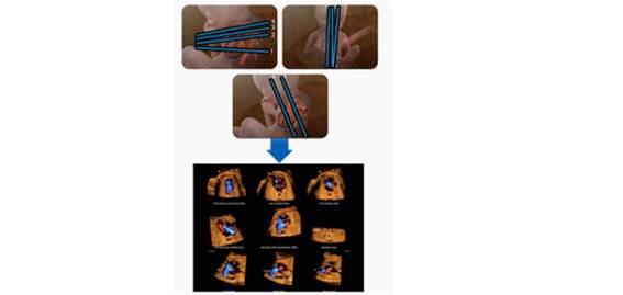 5D Heart Color – ferramenta responsável por uma triagem fetal mais eficaz