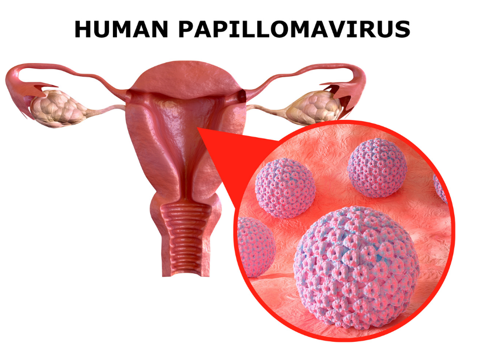 O microbioma cervicovaginal pode influenciar a progressão da infecção pelo HPV | Newslab