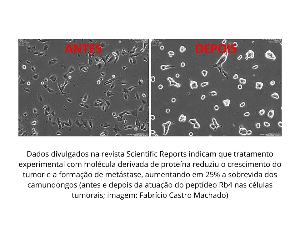 Peptídeo criado por grupo brasileiro retarda avanço do melanoma em testes com animais