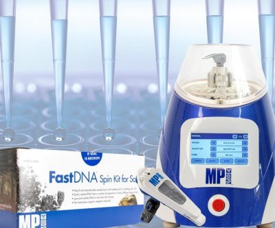 O sistema FastPrep fornece alto rendimento de DNA, RNA e proteína, mesmo de amostras muito resistentes, em até 60 segundos!