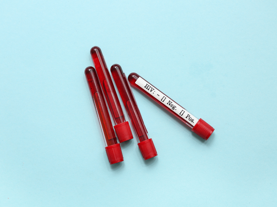 Cortes de verba no combate ao HIV podem causar explosão de casos e milhões de mortes, diz estudo