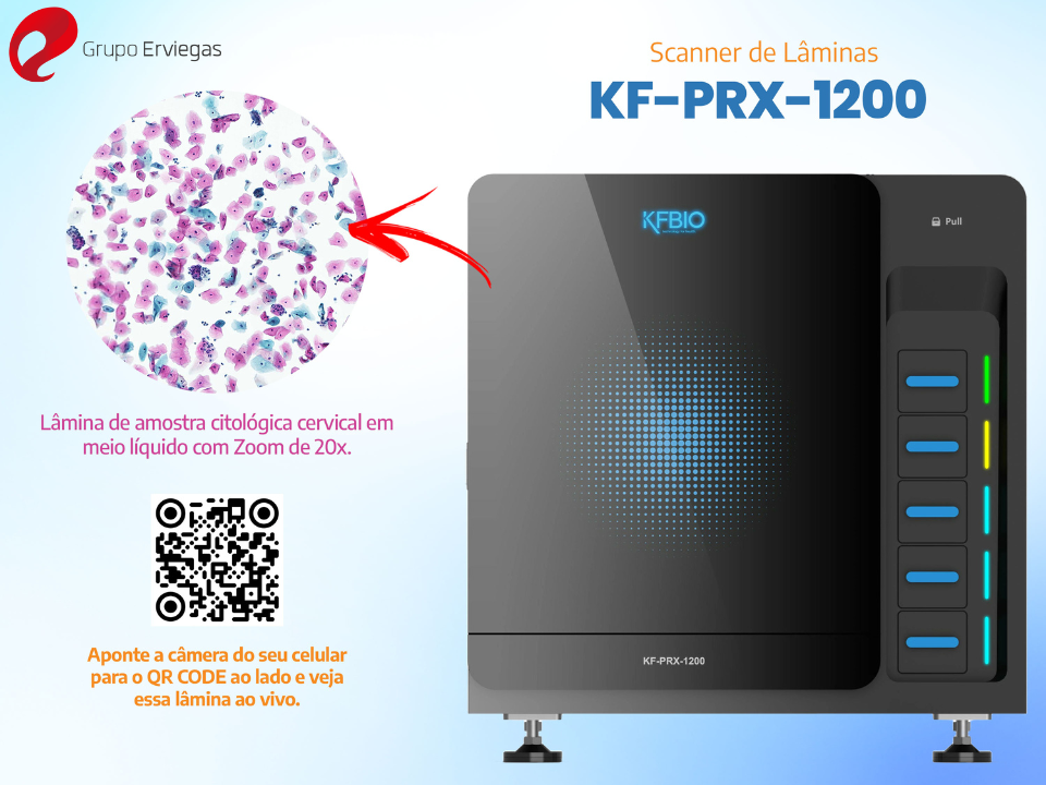 Grupo Erviegas - Scanner de Lâminas KF-PRX-1200