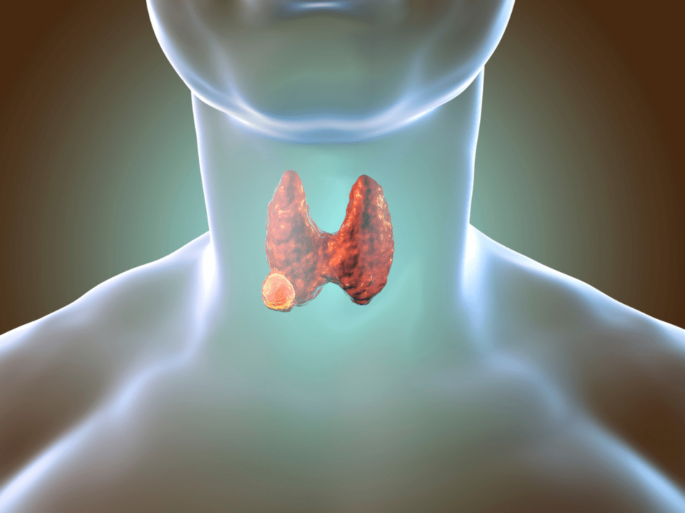 Expedição científica no interior do Ceará investiga mutações raras ligadas ao câncer de tireoide