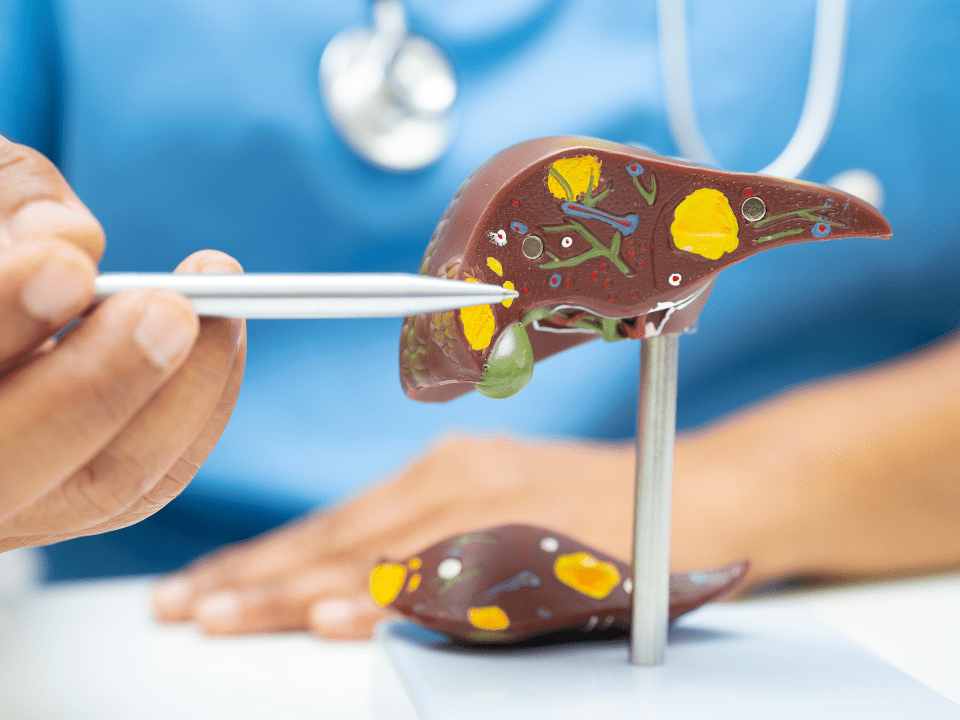 62% dos brasileiros se preocupam com gordura no fígado, diz Datafolha