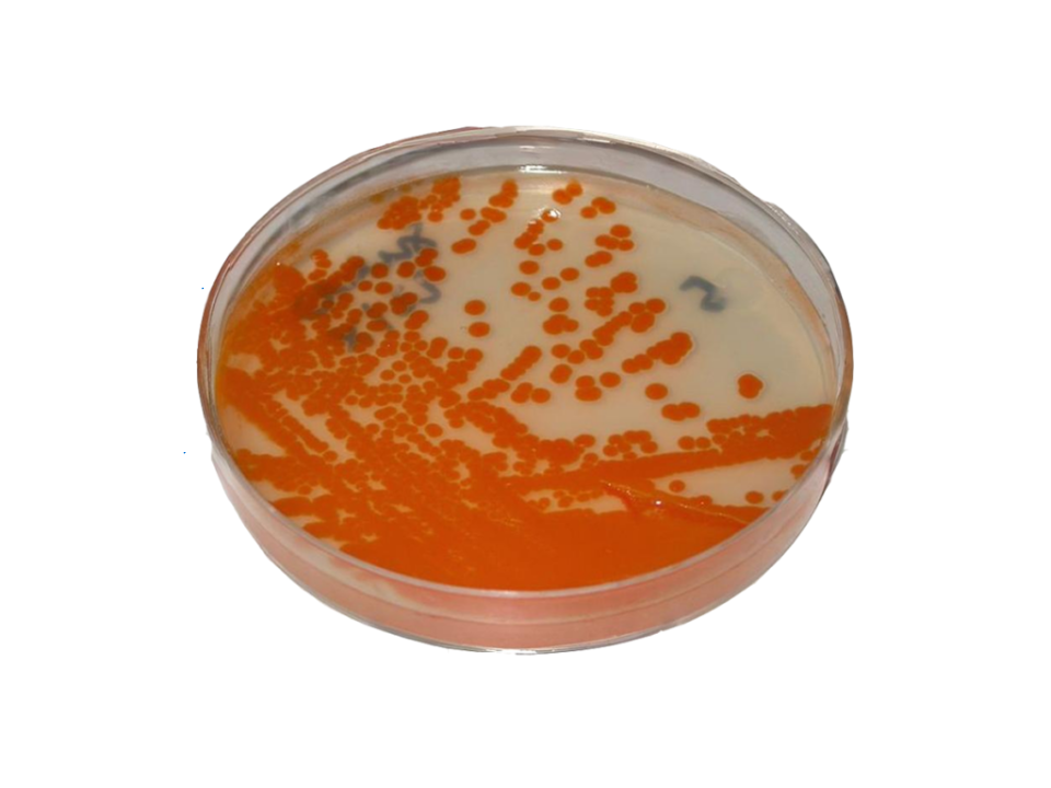 Bactéria comum em gestantes está circulando mais e com maior resistência aos antibióticos