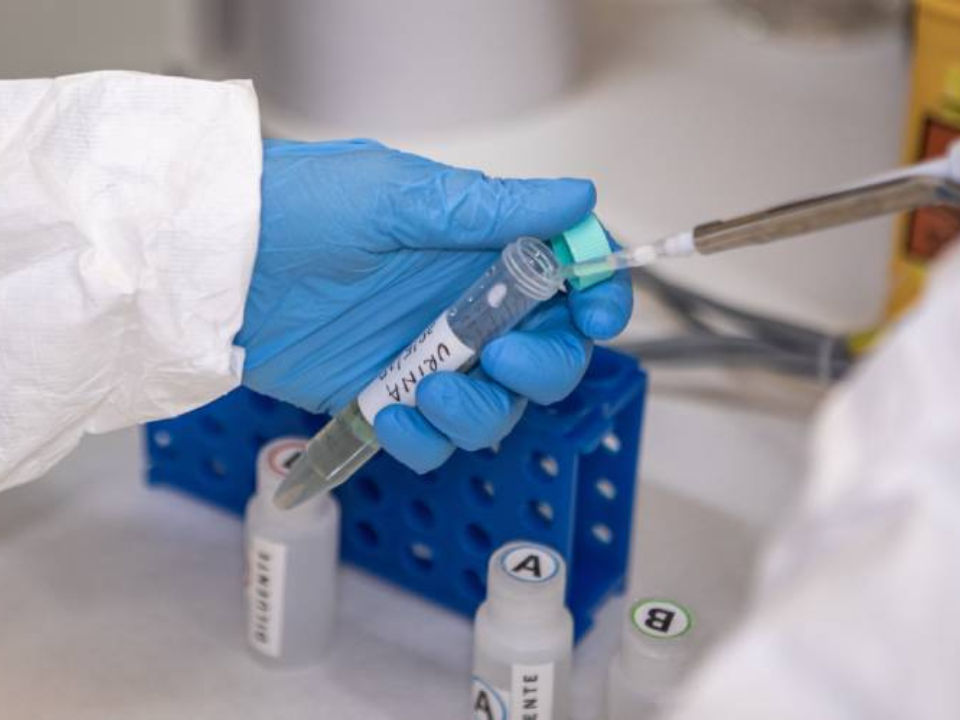 Butantan obtém patentes de dois testes rápidos para diagnóstico de leptospirose que oferecem resultados em 25 minutos