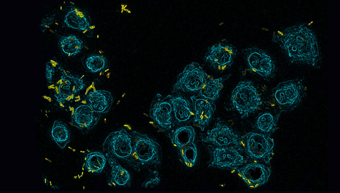 Como bactérias perigosas usam a vitamina C para se proteger do nosso sistema imune