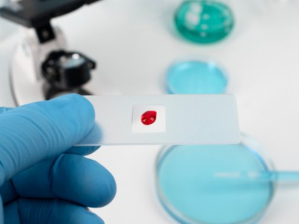 Estudo identifica proteínas envolvidas na eficácia de imunoterapia usada contra câncer no sangue