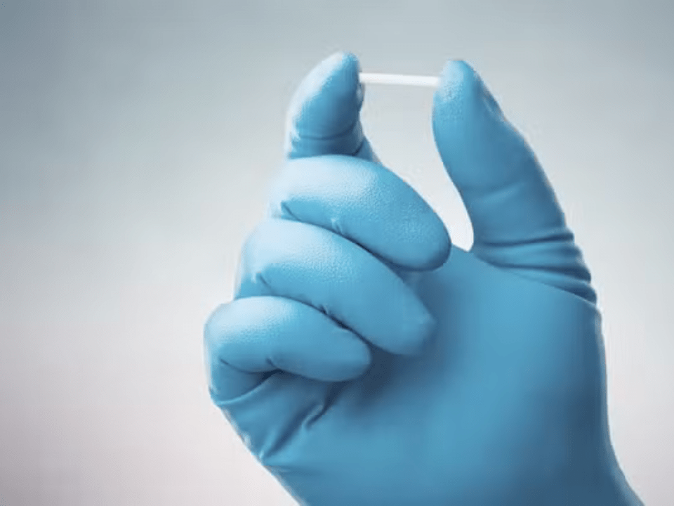 Implante contraceptivo de até R$ 4 mil que dura até três anos chega ao SUS