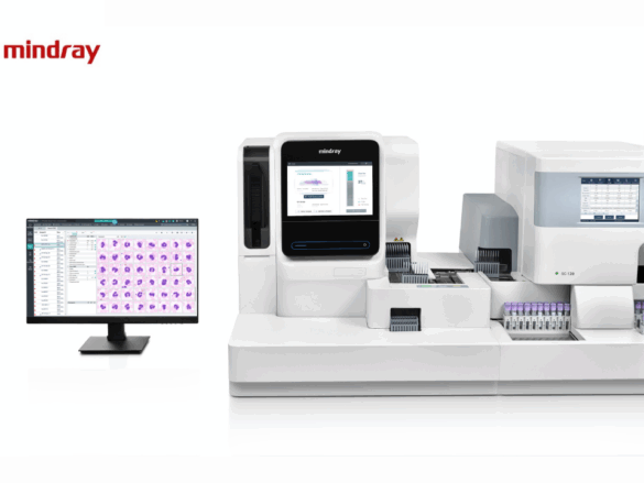 Mindray Avanços da hematologia digital com o apoio da Inteligência artificial