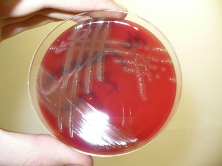 Estudo analisa mecanismo de resistência de bactéria causadora de pneumonia e meningite