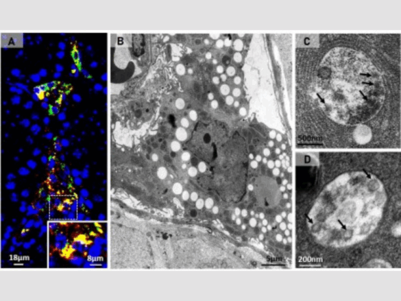 SARS-CoV-2 infecta células dos testículos e usa seus recursos para se multiplicar