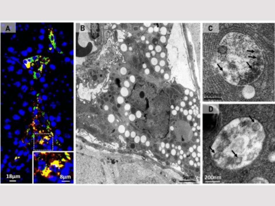 SARS-CoV-2 infecta células dos testículos e usa seus recursos para se multiplicar