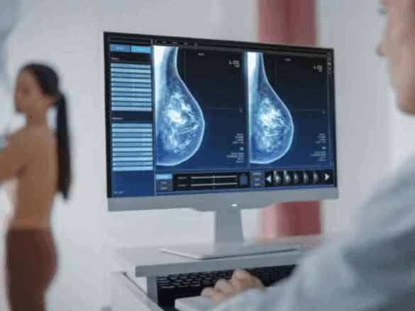 Senado Federal aprova projetos que reduzem para 30 anos a idade mínima para realização de mamografia