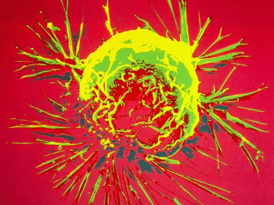 Terapia celular contra câncer, que Padilha quer no SUS, pode custar R$ 3 milhões a um único paciente