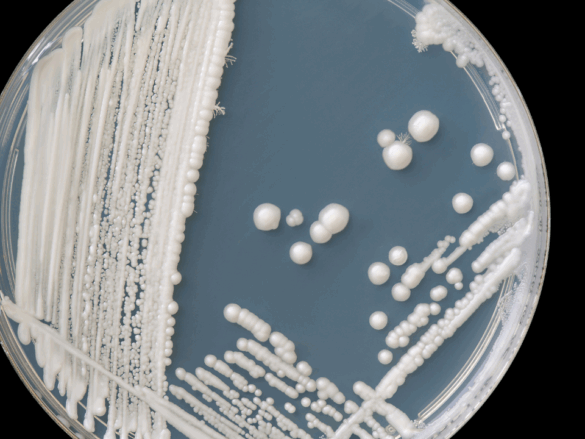 candida albicans como causadora de infecções do trato urinário itu