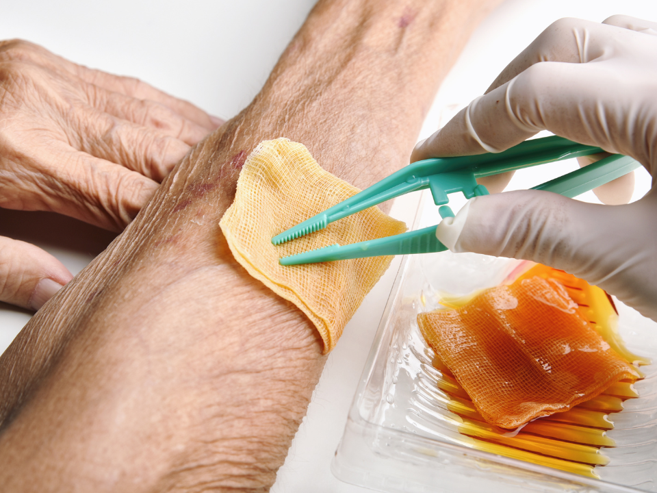 Curativo aumenta a eficácia do tratamento de feridas cutâneas