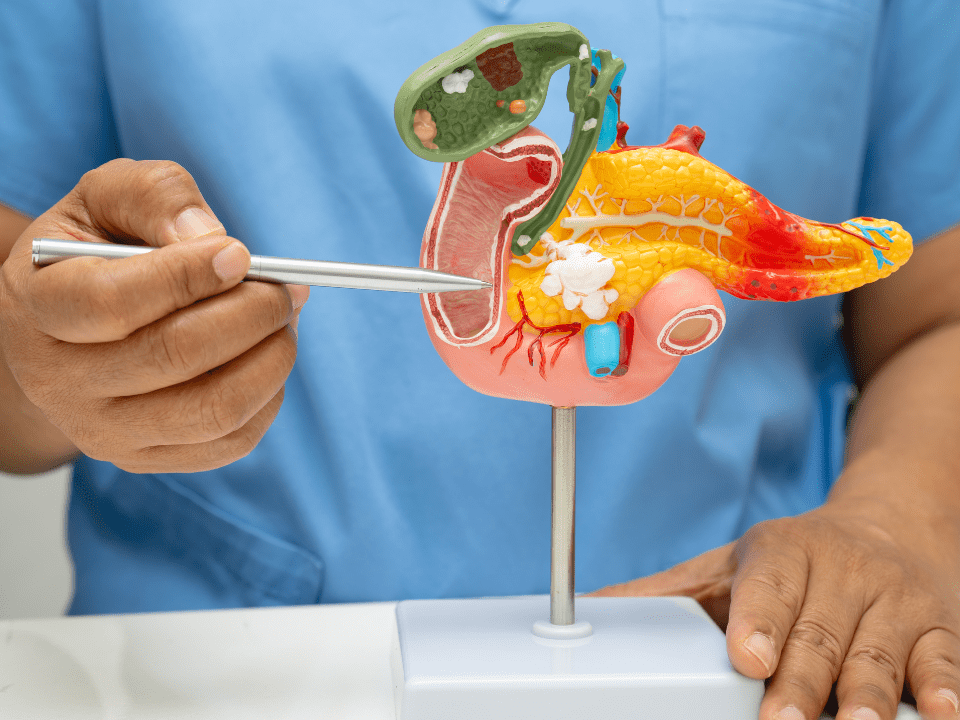 Vacina experimental mostra potencial para frear retorno de câncer de pâncreas e intestino