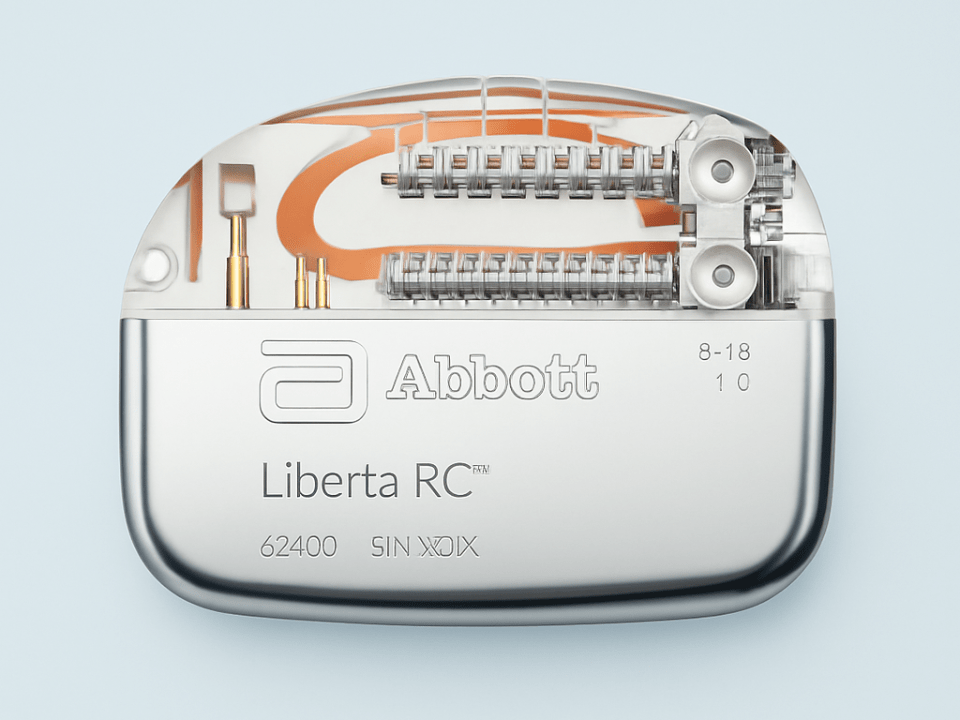 Gerador neuroestimulador Abbott Liberta RC em close, mostrando a estrutura interna, componentes eletrônicos e acabamento metálico usado em sistemas de neuromodulação.