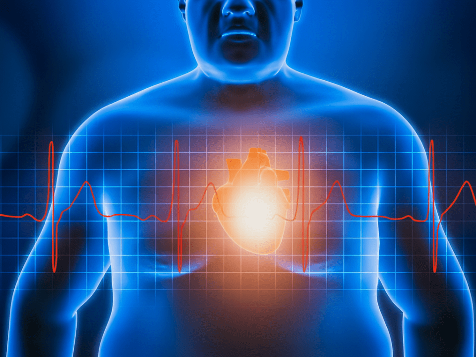 Ilustração médica digital do tórax de um homem com obesidade, destacando o coração iluminado e o traçado de eletrocardiograma, representando riscos cardiovasculares associados à obesidade.