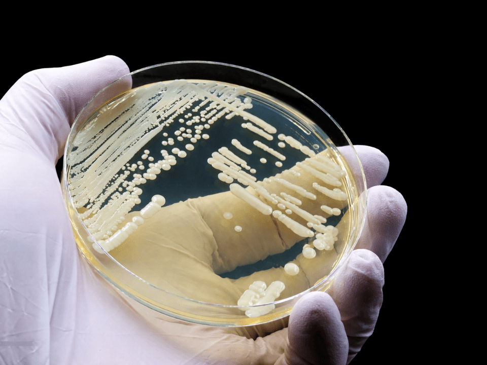 Placa de Petri com colônias de Candida auris em meio de cultura, manipulada por pesquisador com luvas, ilustrando diagnóstico laboratorial de fungos resistentes.