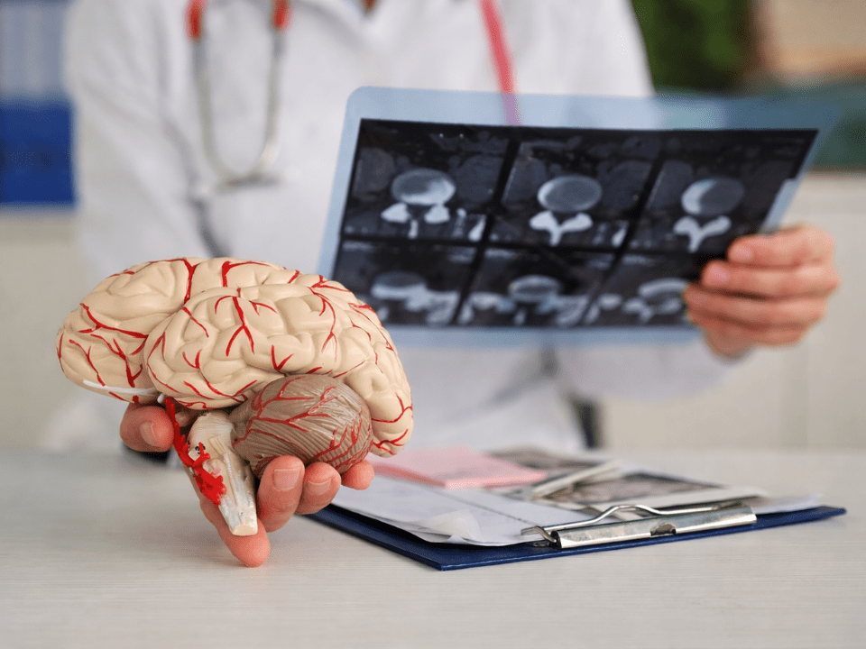 Médico segura modelo anatômico de cérebro humano enquanto analisa imagens de ressonância magnética em estudo sobre novo mecanismo do Alzheimer.