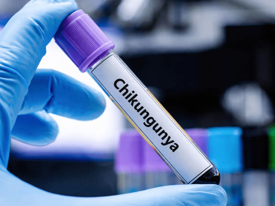 Mão com luva segurando tubo de ensaio com amostra para diagnóstico laboratorial da chikungunya em ambiente de laboratório clínico.