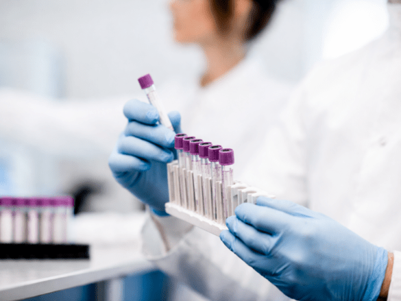 Manipulação de tubos de sangue em laboratório clínico para avaliação de alterações hematológicas no hemograma.