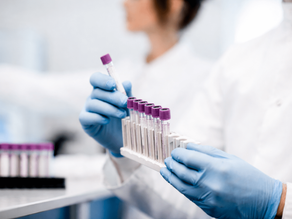 Manipulação de tubos de sangue em laboratório clínico para avaliação de alterações hematológicas no hemograma.