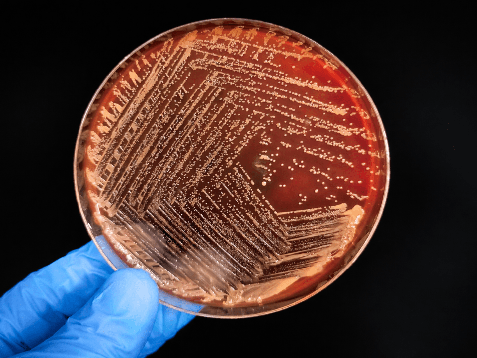 Placa de Petri com crescimento bacteriano em meio de cultura, representando o contexto laboratorial do teste molecular rápido para sepse e a investigação de infecção sanguínea.