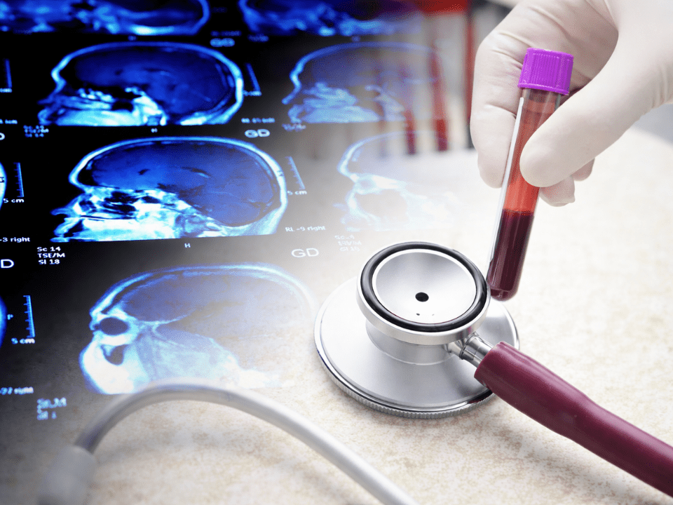 Imagem composta em ambiente clínico mostrando, em primeiro plano, mão com luva segurando tubo de coleta de sangue com amostra venosa. Ao fundo, monitores exibem imagens de ressonância magnética do cérebro em cortes laterais, enquanto um estetoscópio repousa sobre a superfície de trabalho. A cena representa a integração entre biomarcadores sanguíneos e métodos de imagem na avaliação diagnóstica de lesões cerebrais traumáticas, como concussão.