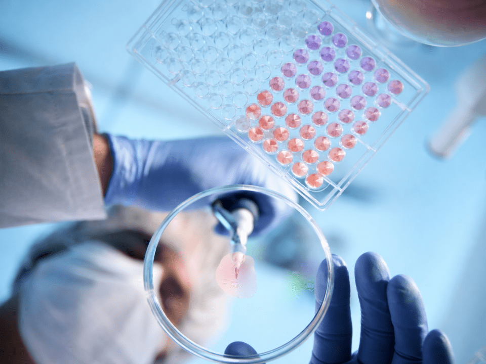 Profissional de laboratório realiza pipetagem em placa de microtitulação, representando diagnóstico rápido e processos laboratoriais em infecções graves.