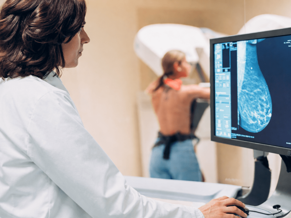 Radiologista analisa imagem de mamografia em monitor enquanto paciente realiza exame de mama em clínica de diagnóstico por imagem, representando mitos e verdades da mamografia.