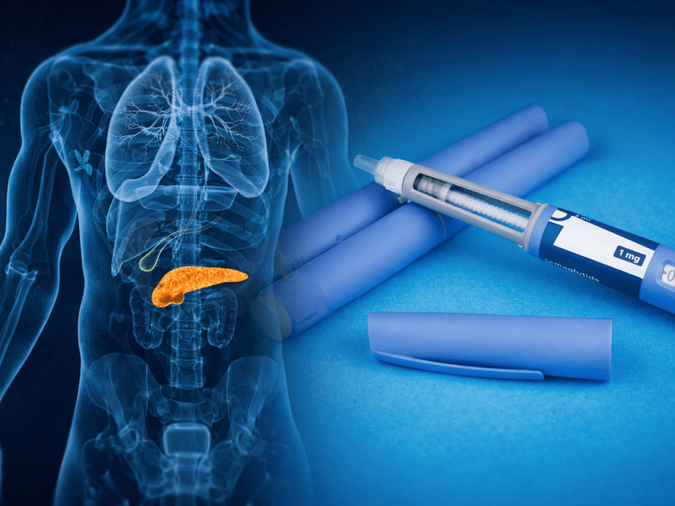 Imagem composta com pâncreas destacado e canetas de agonistas GLP-1, ilustrando alerta sobre pancreatite e canetas emagrecedoras.