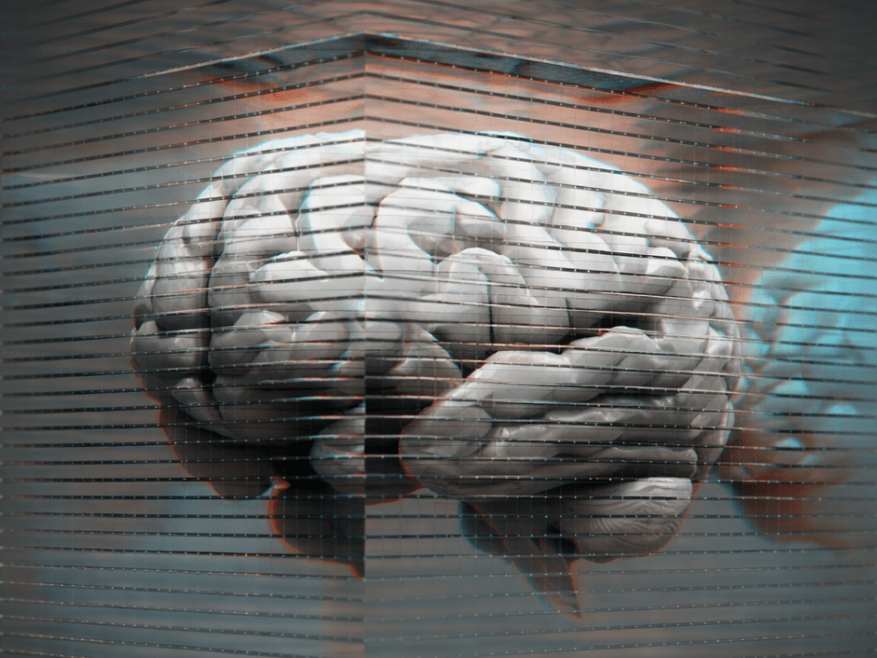 Cérebro humano em renderização tridimensional com efeito de varredura digital e linhas horizontais, representando inteligência artificial aplicada à ressonância magnética cerebral no diagnóstico neurológico.