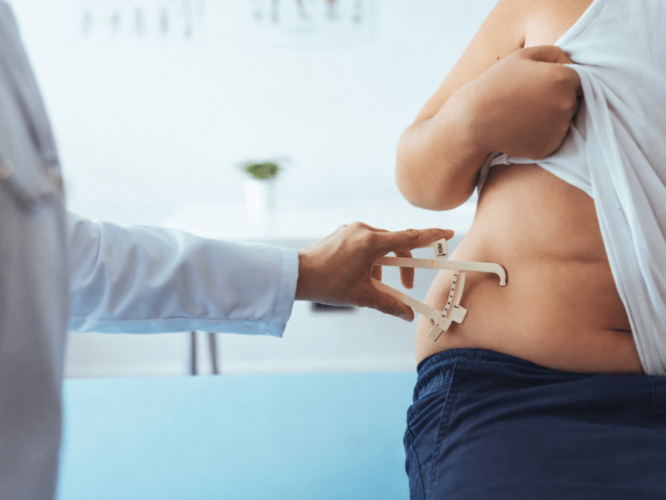 Avaliação clínica de gordura corporal com adipômetro durante consulta médica para diagnóstico e acompanhamento da obesidade.