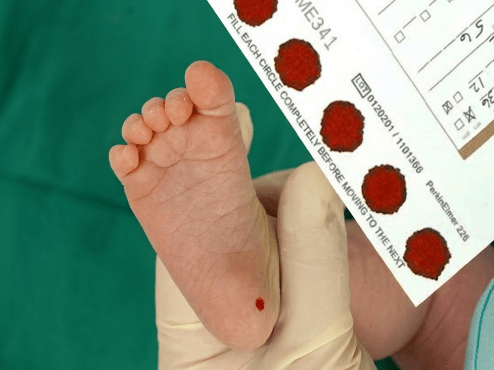 profissional de saúde realizando o teste do pezinho em recém-nascido durante triagem neonatal para diagnóstico precoce de doenças genéticas como fibrose cística no Brasil.