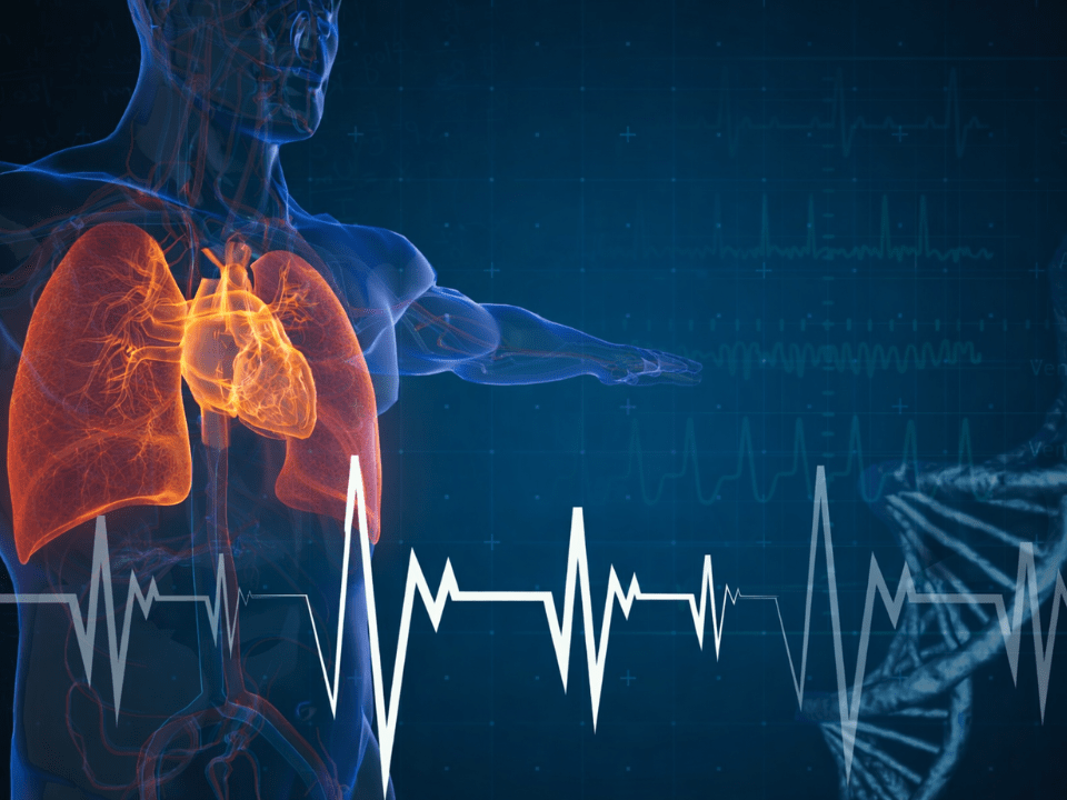 Hipertensão pulmonar e UCP2 em imagem biomédica com pulmões e coração destacados, sugerindo risco de falência ventricular direita.