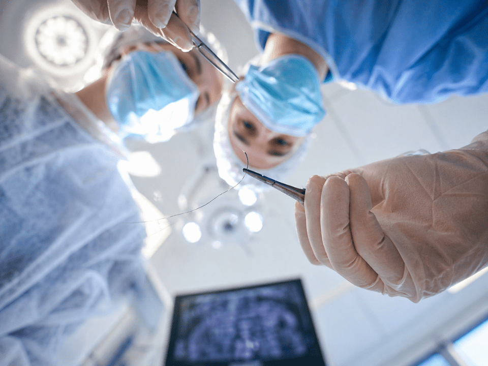 Suturas com liberação de anti-inflamatórios.