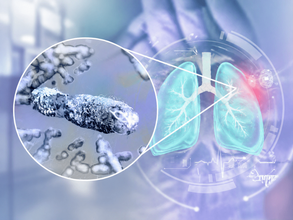 Ilustração científica do Mycobacterium tuberculosis associada aos pulmões humanos, representando biossensor para tuberculose ativa e diagnóstico rápido da infecção em contexto clínico.