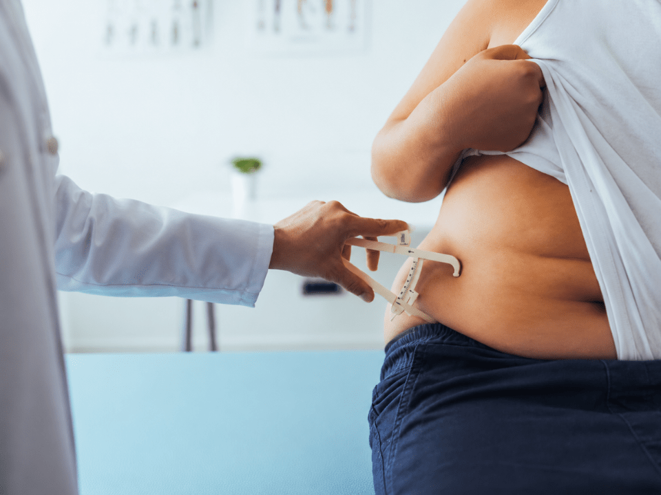 Profissional de saúde realiza avaliação antropométrica abdominal com adipômetro em paciente com excesso de peso, em ambiente clínico, ilustrando o avanço da obesidade como principal fator de risco no Brasil e a importância do diagnóstico precoce e do monitoramento metabólico.