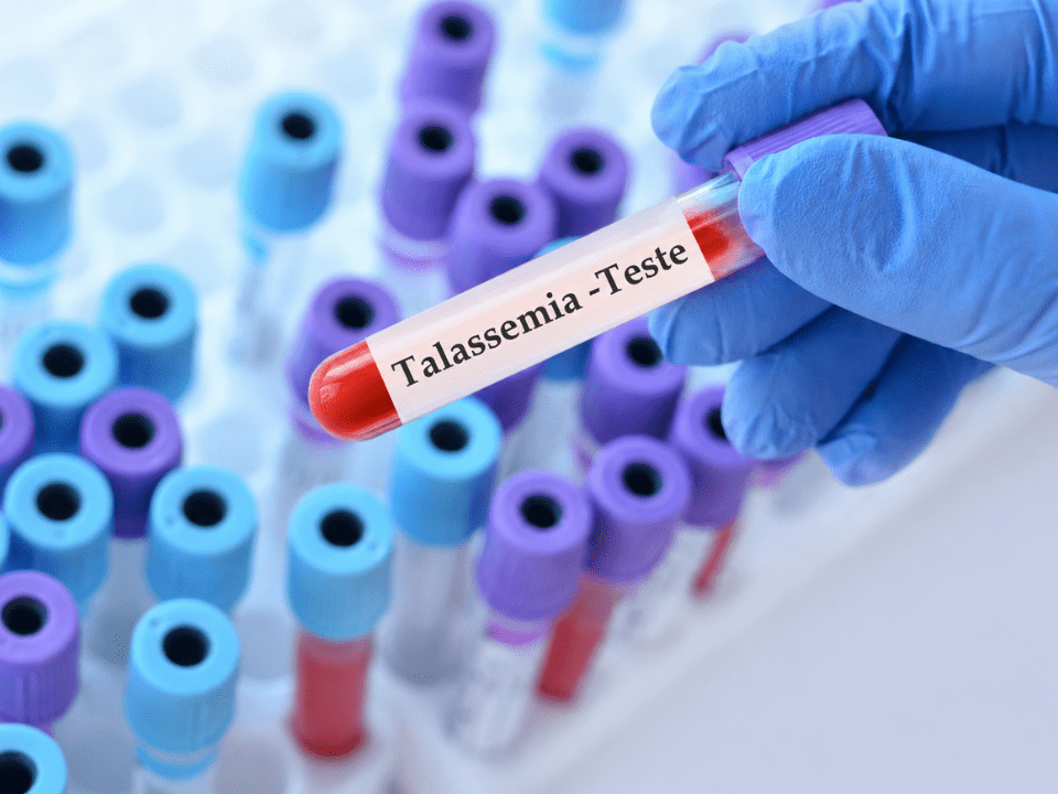 Imagem de tubo de coleta sanguínea identificado como “Talassemia -Teste” em ambiente laboratorial, ilustrando o Dia da Talassemia e a importância do diagnóstico laboratorial precoce das hemoglobinopatias por meio de exames hematológicos especializados.