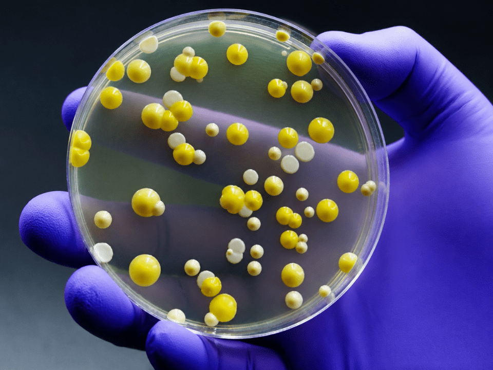 Placa de Petri com colônias bacterianas multirresistentes sendo analisadas em laboratório microbiológico, ilustrando o avanço da vigilância genômica bacteriana no monitoramento da resistência antimicrobiana em ambientes hospitalares.