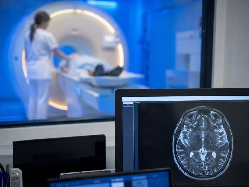 Monitor com imagem cerebral em sala de diagnóstico por imagem, ilustrando coloração virtual por tomografia, inteligência artificial e novas aplicações da patologia digital em 3D.