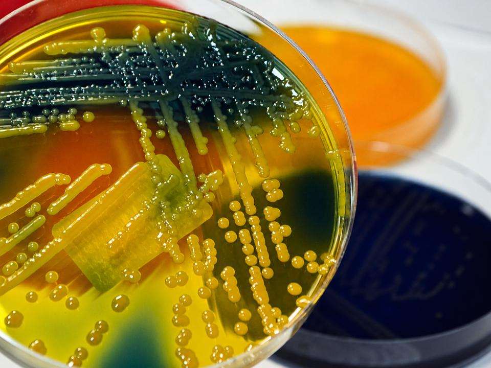 Placa de cultura microbiológica com crescimento de Klebsiella pneumoniae multirresistente em meio de cultivo seletivo, ilustrando a resistência antimicrobiana associada às infecções urinárias e a importância da vigilância laboratorial para o monitoramento de bactérias resistentes a antibióticos.