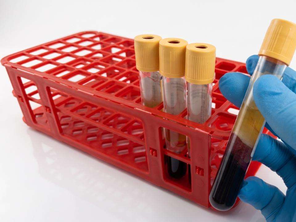 Resultado em até três dias: o diferencial do exame dd-cfDNA também está no uso de tubos específicos que preservam a amostra e permitem a análise molecular por sequenciamento de nova geração, tecnologia já empregada pelo Igen em exames de histocompatibilidade na área de transplantes.
