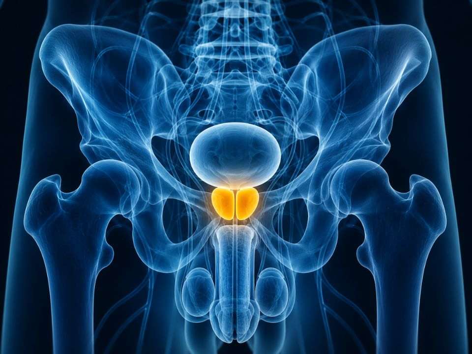 CRISPR de RNA no câncer de próstata restaurando a apresentação de antígenos tumorais e a resposta à imunoterapia.