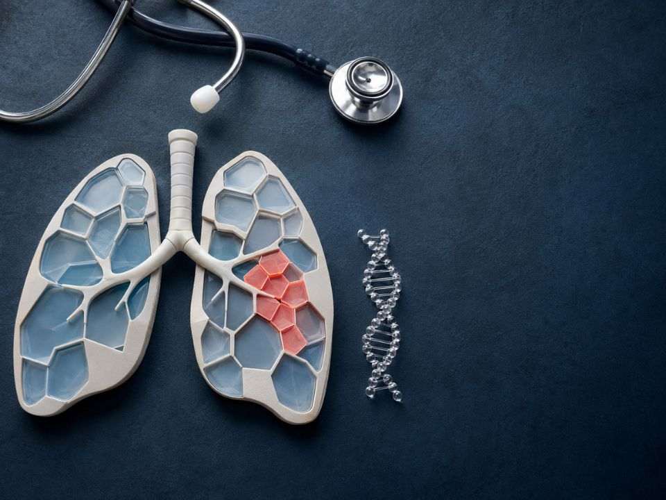 Anvisa amplia a indicação do Datroway para pacientes com câncer de pulmão de não pequenas células e mutação em EGFR.