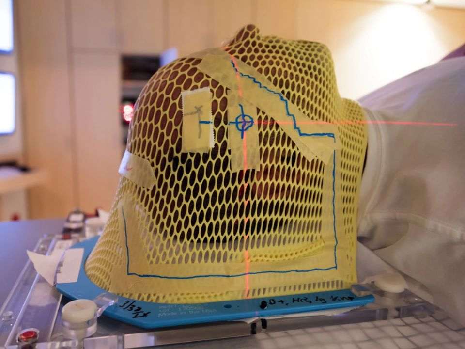 Paciente com máscara de imobilização e laser de posicionamento durante tratamento do câncer de cabeça e pescoço por radioterapia.