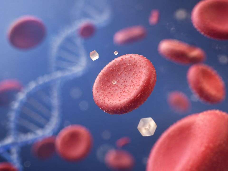 Escore genético para diabetes tipo 1 representado por hemácias, cristais de glicose e DNA translúcido em fundo azul.